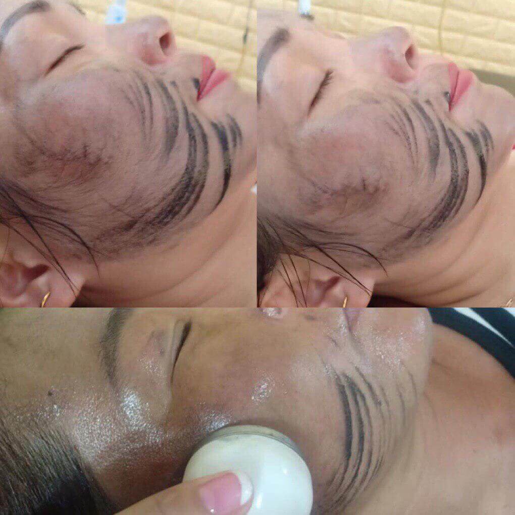HCM - Voucher spa - Thải chì độc tố cho da mặt tại L'Belle Beauty Spa
