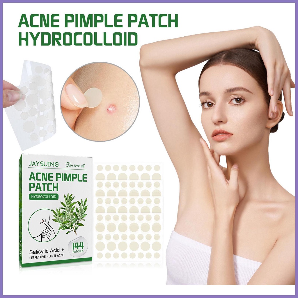 Miếng Dán Trị Mụn Vô Hình 144 Miếng nota2vn