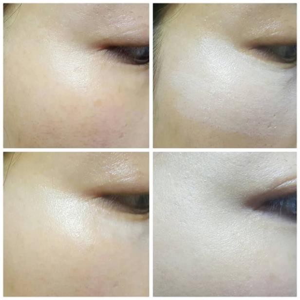 TƯƠNG TÁC SHOPEE - 1 viên cao nám làm giảm tàn nhang, đốm nâu | BigBuy360 - bigbuy360.vn