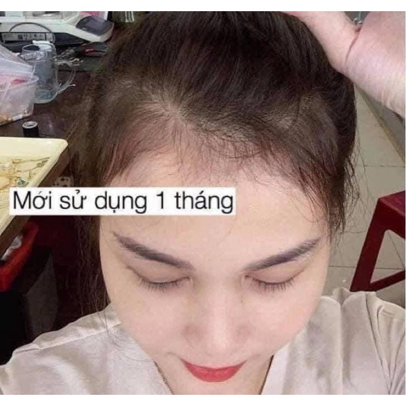 Xịt Mọc Tóc Bưởi Xanh Tự Nhiên 100ML