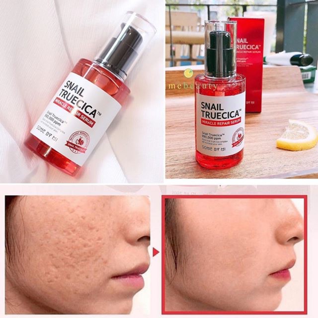 Tinh Chất Some By Mi Snail Truecica Miracle Repair Serum 50ml