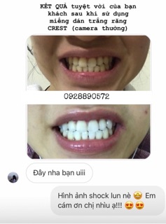 MIẾNG DÁN TRẮNG RĂNG CREST 3D WHITE ✨ LOẠI Professional