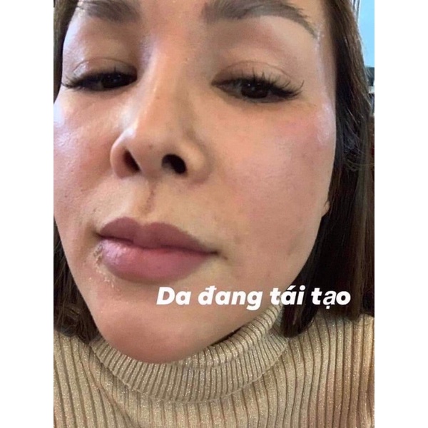 5 HỘP KEM CHAMOMILESKILL