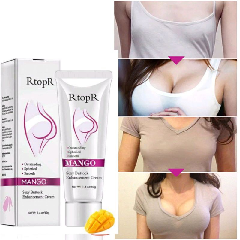 Kem Nở Mông Xóa Thâm Cao Cấp | BigBuy360 - bigbuy360.vn