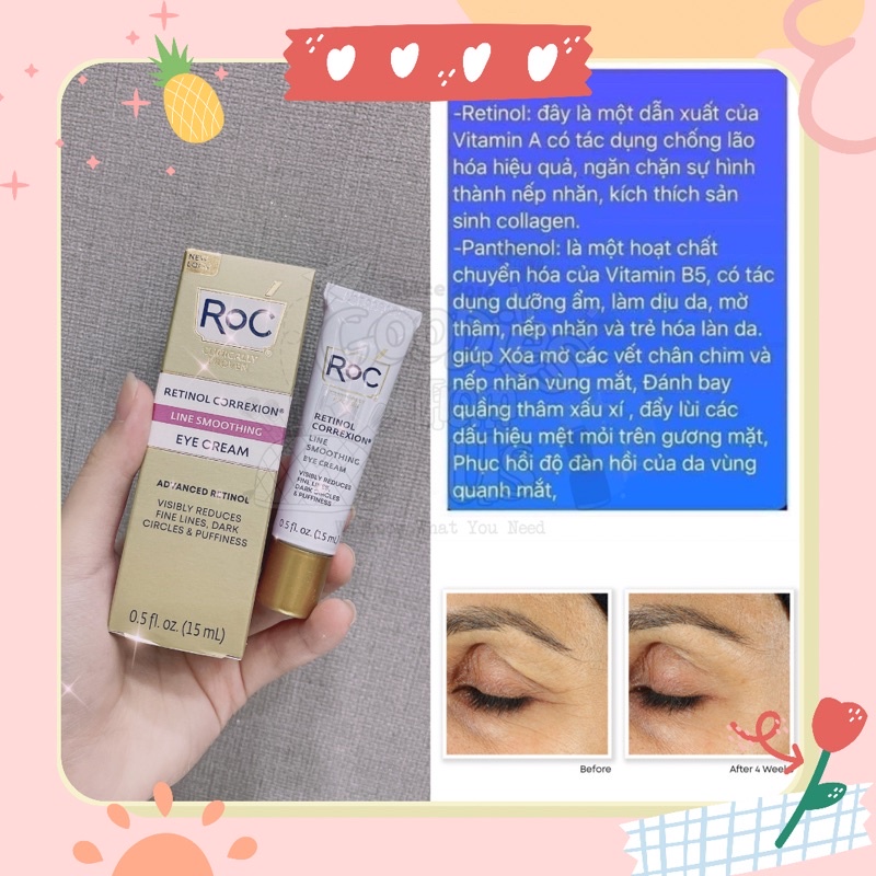 Kem dưỡng mắt RoC Retinol Correxion Eye Cream SALE !!