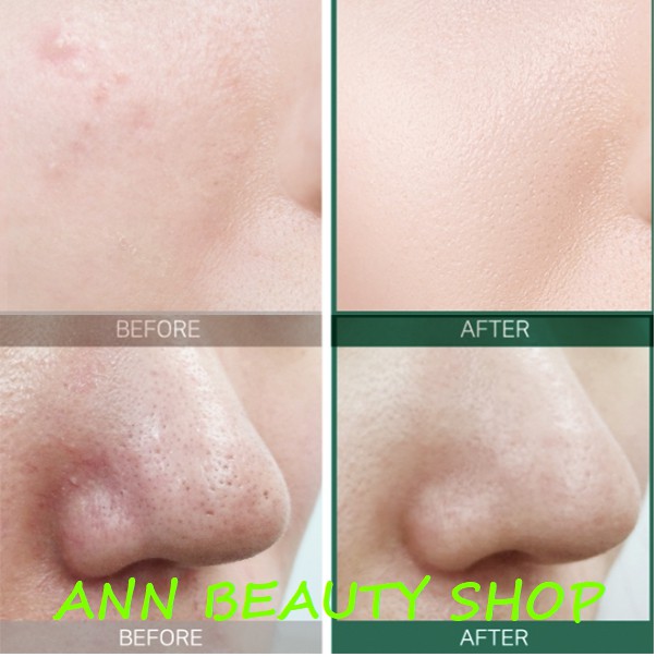 Toner tái tạo làn da AHA-BHA-PHA 30DAYS TONER SOME BY MI | BigBuy360 - bigbuy360.vn