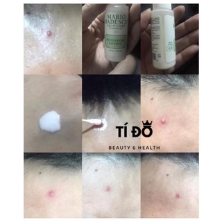 MARIO BADESCU - Lotion Chấm Mụn Buffering Lotion