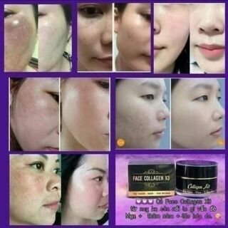Kem face Collagen x3