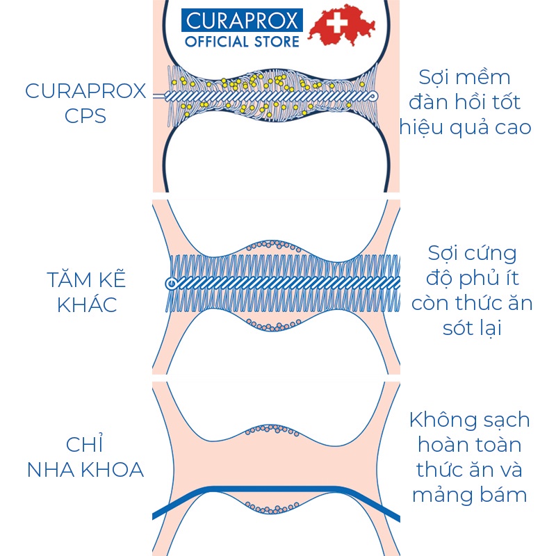 [Mã BMBAU50 giảm 7% đơn 99K] Bộ 5 Tăm Kẽ Răng Dành Cho Nha Chu Curaprox Period Plus 406 Kích Cỡ 1.7mm