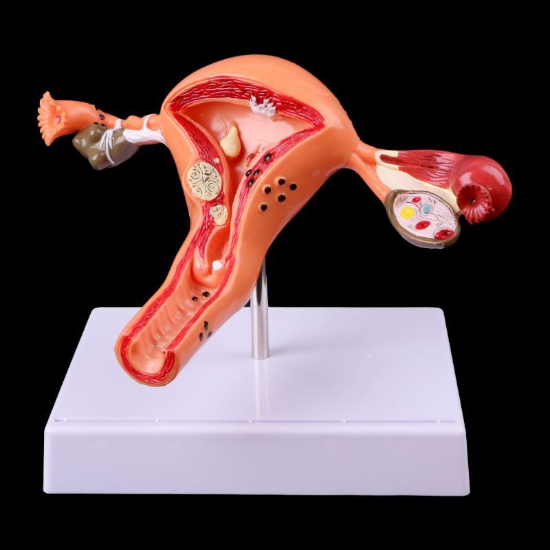 Wer Mô Hình Giải Phẫu Uterus Ovary Cho Học Sinh