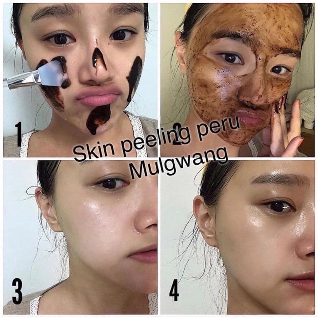 Tẩy Da Chết Peel Beigic Correcting Exfoliator | BigBuy360 - bigbuy360.vn