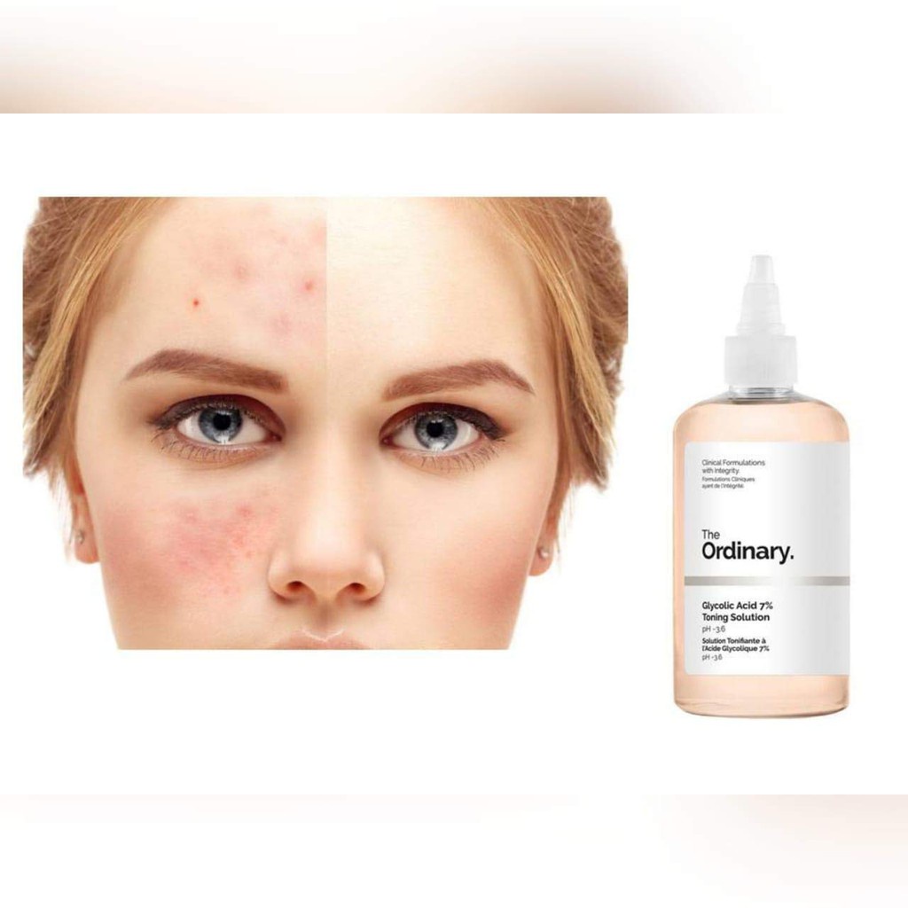 Nước Hoa Hồng Toner The Ordinary Glycolic Acid 7% + Toning Solution 240ml