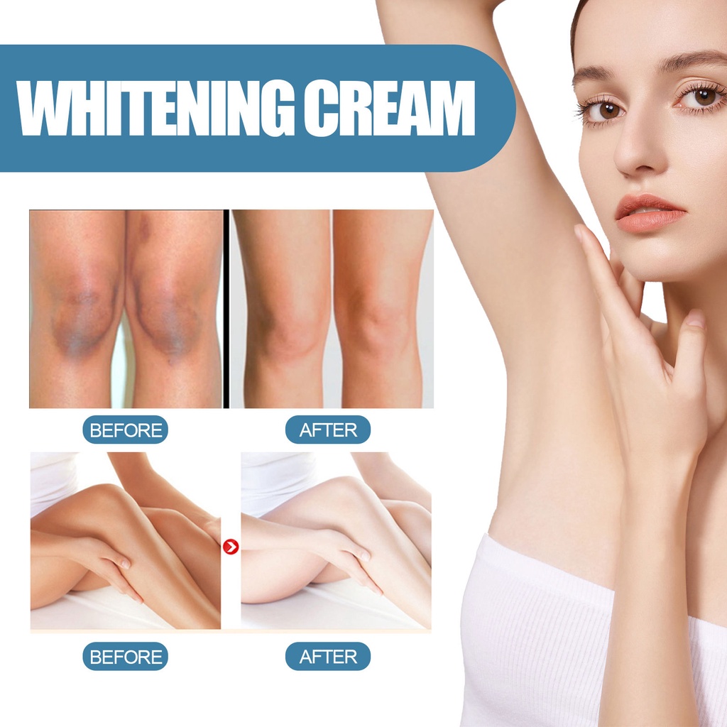 Kem Dưỡng Trắng Da Vùng Dưới Cánh Tay / Đầu Gối / Toàn Thân 60g