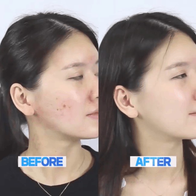 TINH CHẤT RAU MÁ MADAGASCAR SKIN 1004