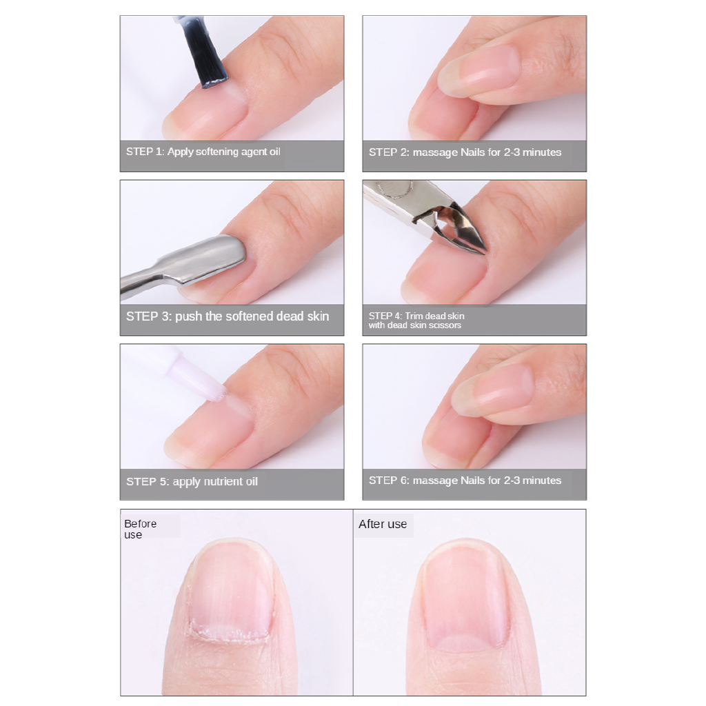 (hàng Mới Về) Kềm Cắt Da Chết Chuyên Nghiệp Bằng Thép Không Gỉ Màu Vàng Và Bạc