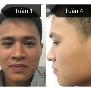 SERUM DƯỠNG TRẮNG DA M.E.N.L.Y
