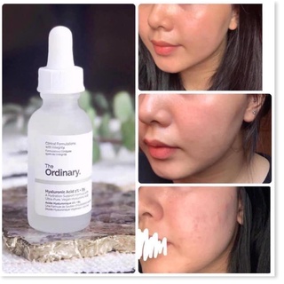 The Ordinary - Tinh chất cấp ẩm 2% + B5