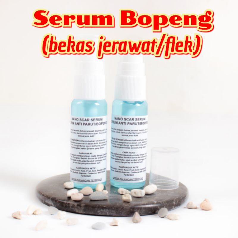 (Hàng Mới Về) Serum Trị Sẹo Mụn Pockle Chất Lượng Cao