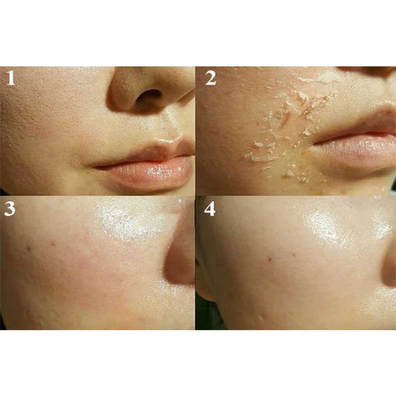 VI KIM TẢO BIỂN PEEL DA SINH HỌC NHẬP KHẨU NHẬT BẢN