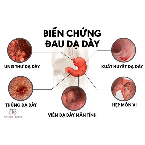 Bột dạ dày thảo mộc LITIC250g cải thiện đau dạ dày tá tràng hiệu quả