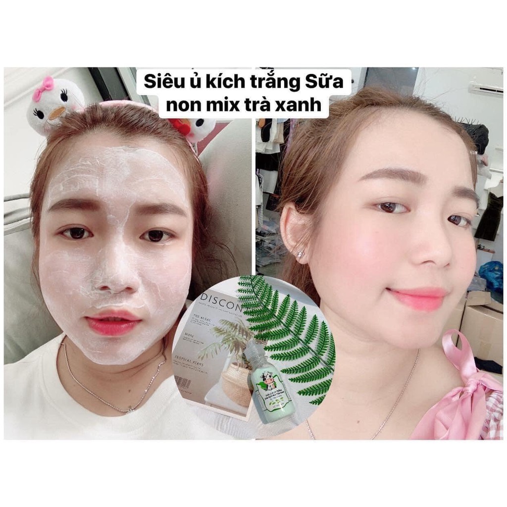 Ủ Sữa Non Kích Trắng Face & Body (mix Trà Xanh) - Hàng Chính Hãng | BigBuy360 - bigbuy360.vn
