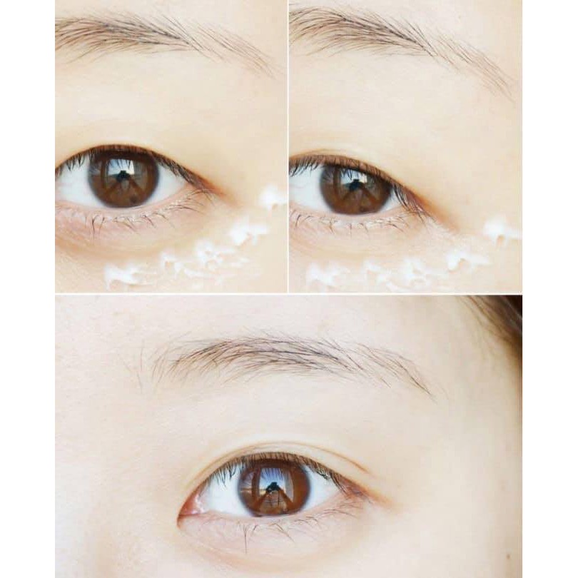 KEM MẮT 3W CLINIC | BigBuy360 - bigbuy360.vn