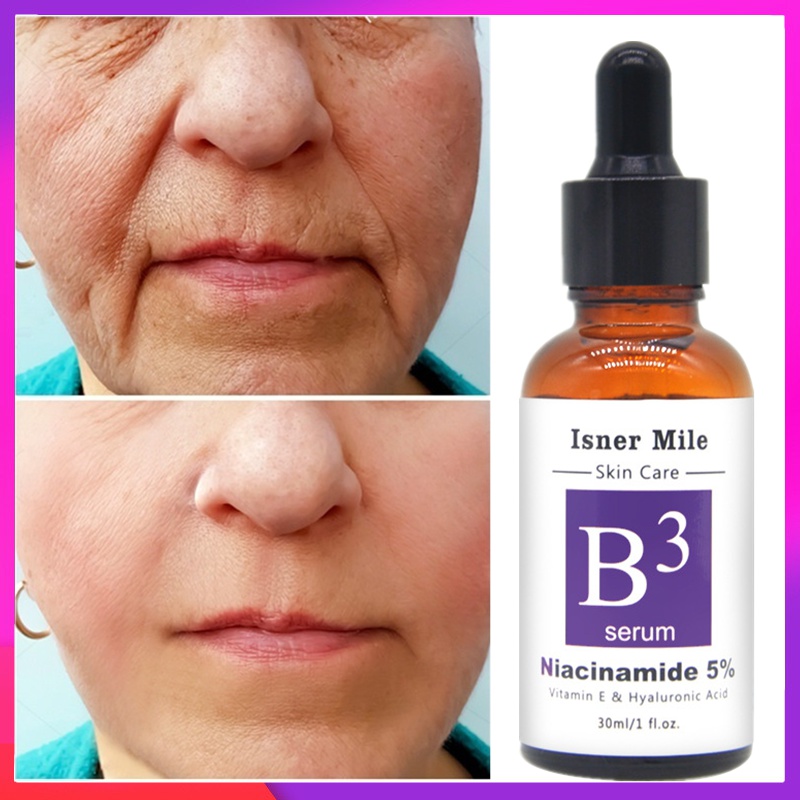 (Hàng Mới Về) Tinh Chất Niacinamide Hyaluronic Acid 5% Dưỡng Ẩm Chống Lão Hóa Chăm Sóc Da | BigBuy360 - bigbuy360.vn