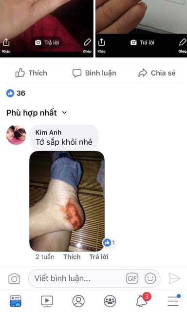 [CỰC HIỆU QUẢ] Bôi Hỗ Trợ Á Sừng Tổ Đỉa Nấm Nứt Gót Chân Hắc Lào | BigBuy360 - bigbuy360.vn