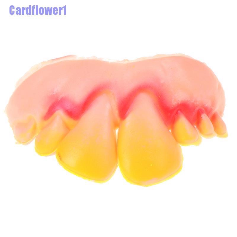 10 Hàm Răng Giả Đẹp