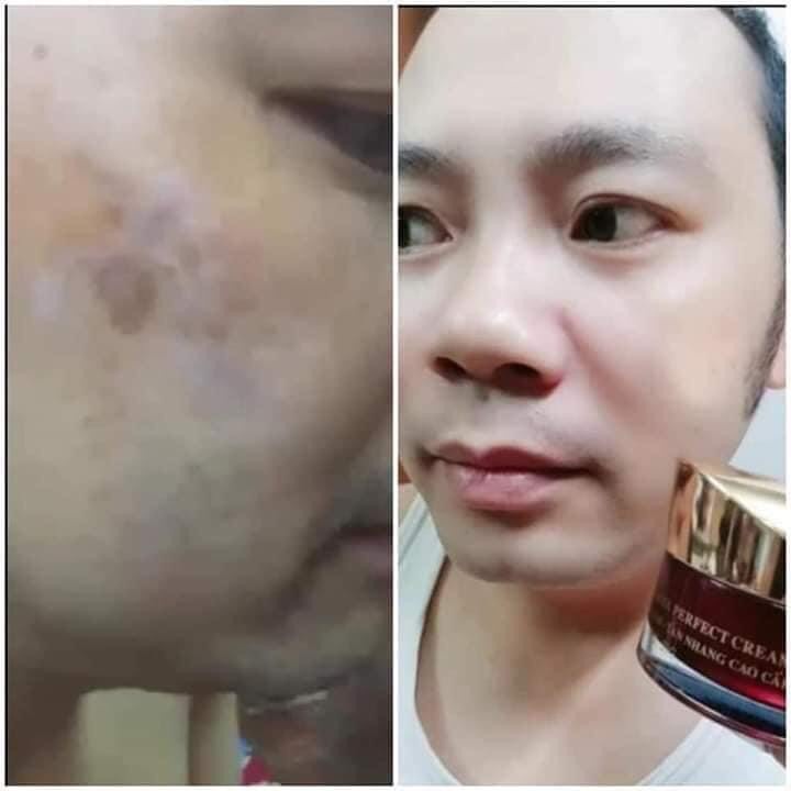 Kem dưỡng đêm ngừa nám trắng da H&H SPA - melasma perfect cream