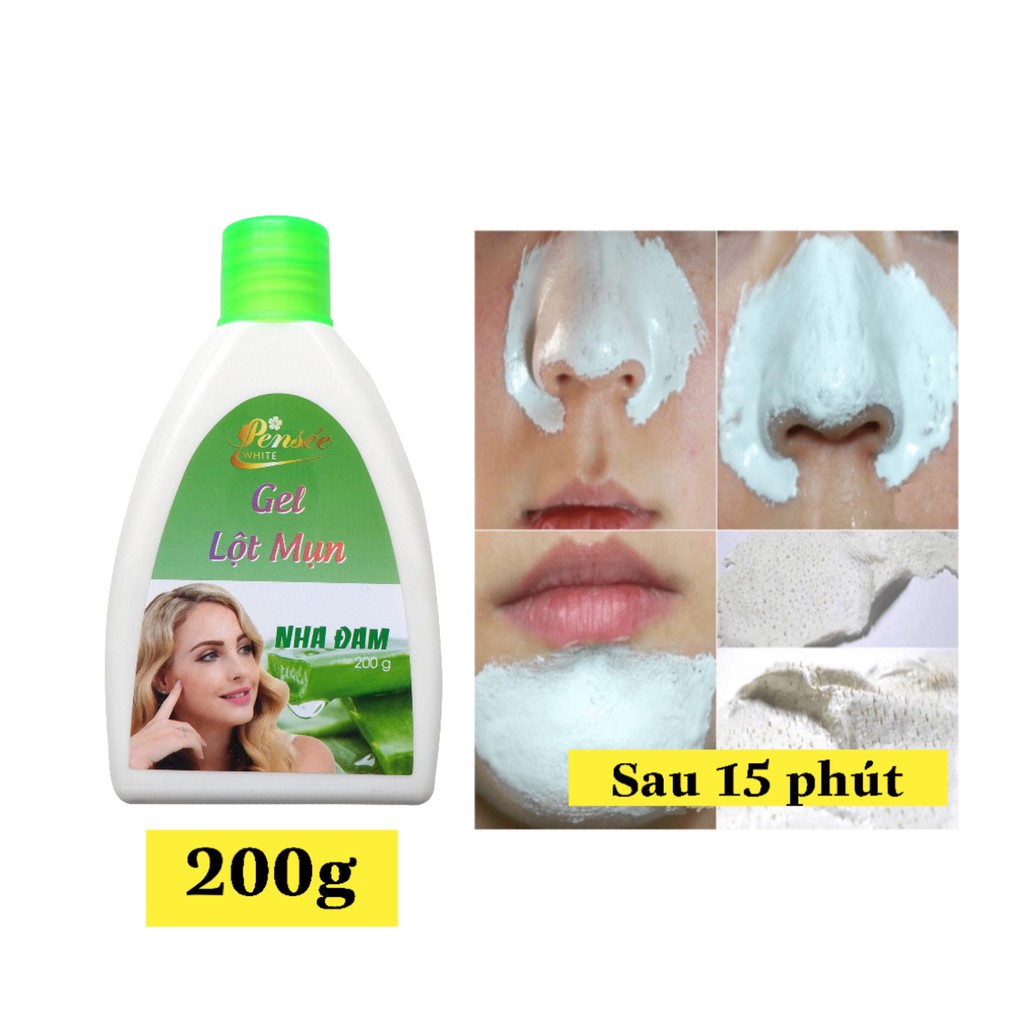 Gel lột mụn đầu đen, mụn cám nha đam Wicbe 200g - gel hút mụn Wicbe