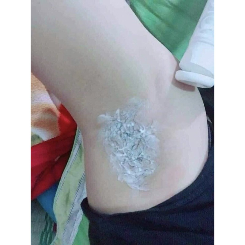 KEM TẨY LÔNG THANH TRANG | BigBuy360 - bigbuy360.vn