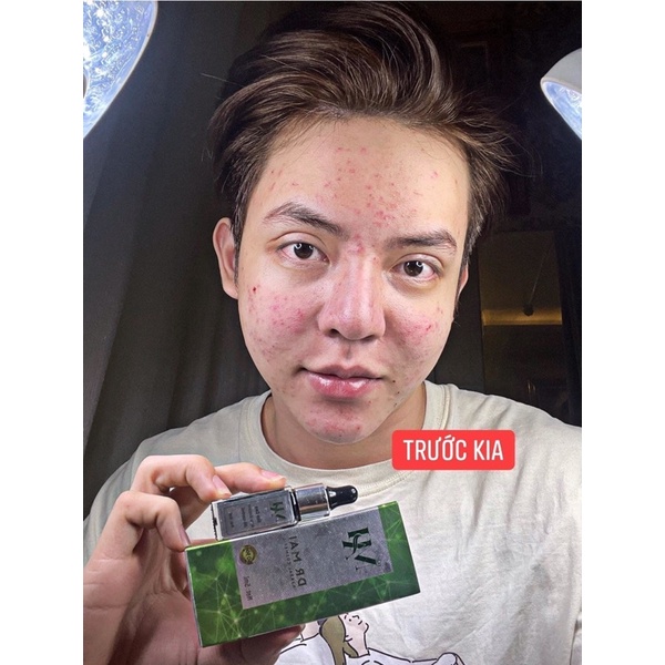 [CHÍNH HÃNG]DR MAI NGUYÊN CHẤT CHUYÊN MỤN NẶNG/PHỤC HỒI DA HƯ TỔN | BigBuy360 - bigbuy360.vn