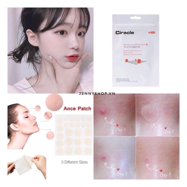 🍀MIẾNG DÁN MỤN CIRACLE RED SPOT ACNE PIMPLE PATCH