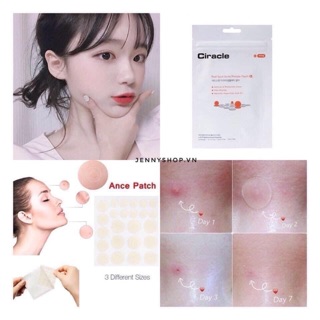 🍀MIẾNG DÁN MỤN CIRACLE RED SPOT ACNE PIMPLE PATCH
