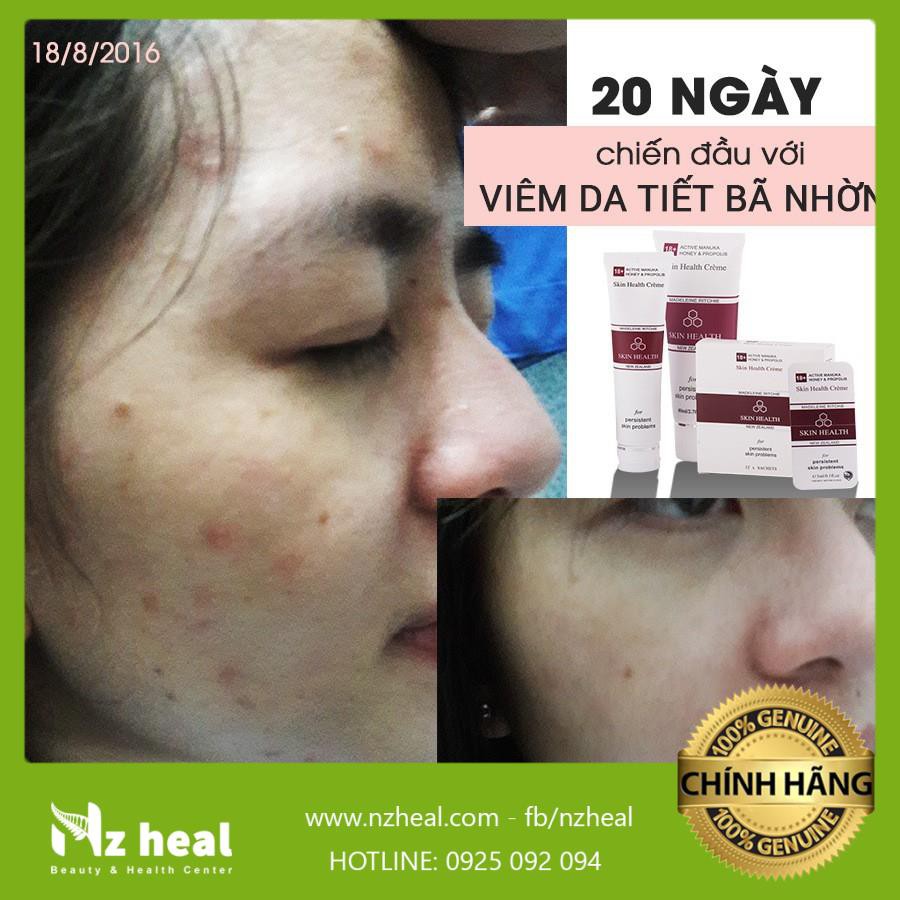 Kem Mật Ong Manuka 18+ Giảm Mụn, Mờ Thâm, Làm Dịu Da Dị Ứng Skin Health Crème hàng chính hãng | BigBuy360 - bigbuy360.vn