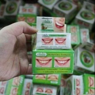 TẨY TRẮNG RĂNG  GREEN HERB THÁI LAN
