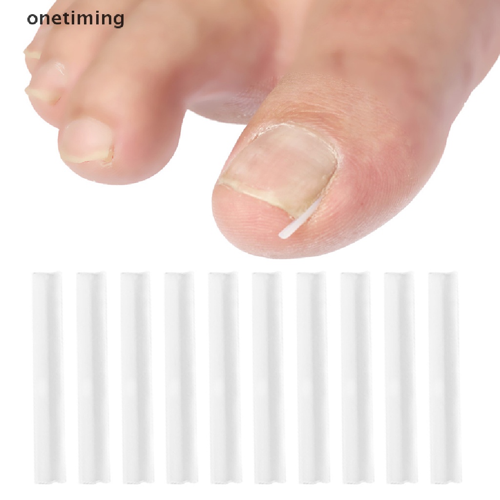 Đệm Silicone Hỗ Trợ Định Hình Móng Tay