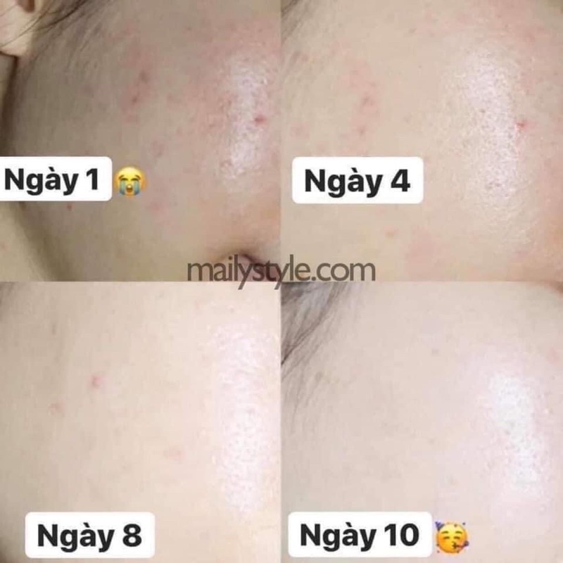 Kem Retinol A313 50g | BigBuy360 - bigbuy360.vn
