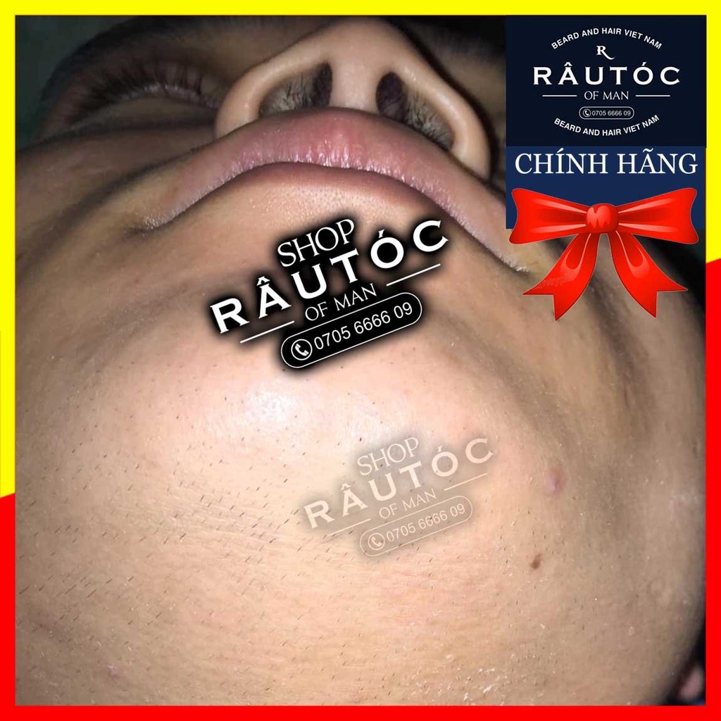 Minoxidil 5% dạng lỏng chính hãng Mỹ tặng 1 ống LCLT