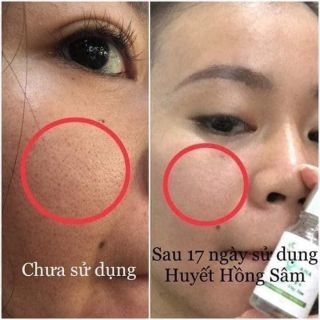 Huyết Hồng Sâm OHANA Hàn Quốc