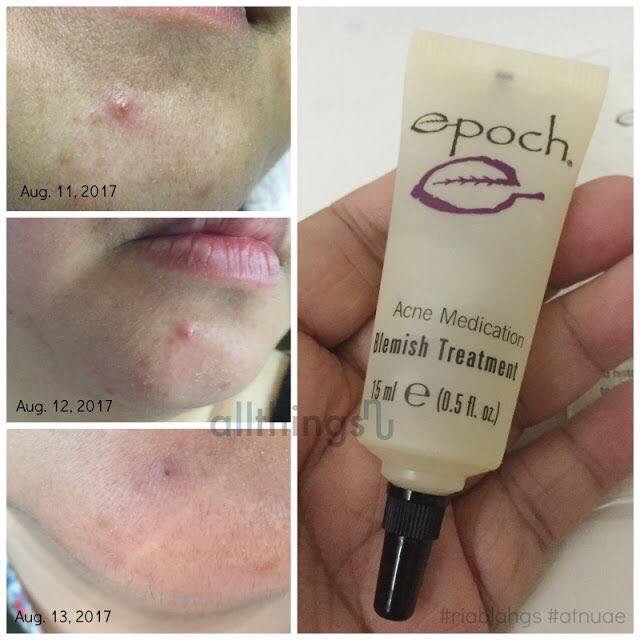 Kem giúp giảm mụn Epoch Blemish Treatment 15ml