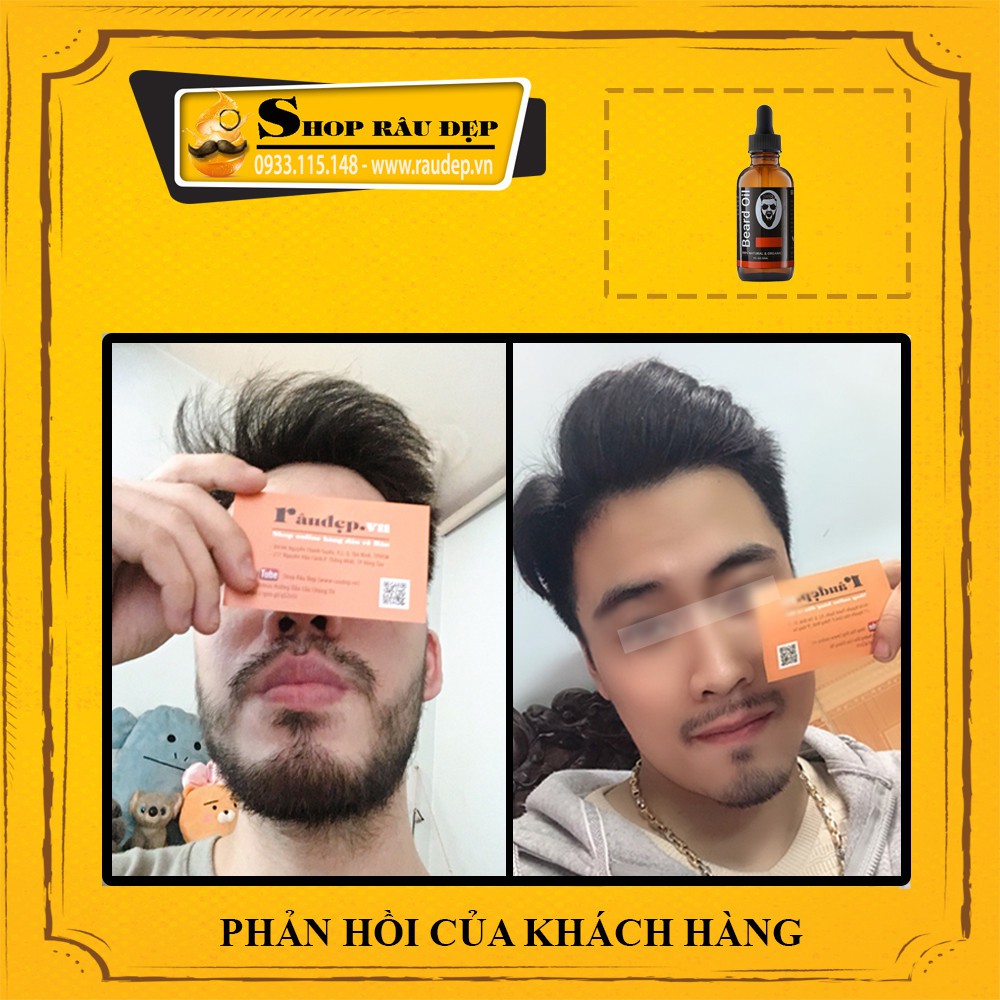 Dầu Dưỡng Râu - Chống Khô Da Khi Dùng Minoxidil 5%