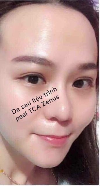 Peel TCA Zenus 50% | BigBuy360 - bigbuy360.vn