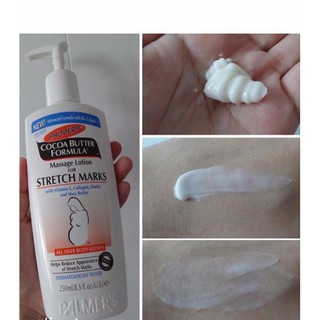 KEM TRỊ RẠN DA VÀ SĂN CHẮC DA CHO BÀ BẦU