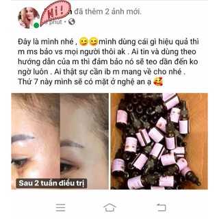 Tiêu cồi mụn 24h