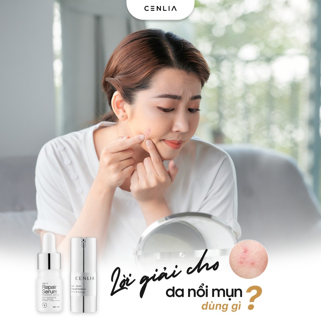 Kem ngừa Mụn Cenlia chuyên về ngừa mụn, tái tạo da,loại bỏ các loại mụn cứng đầu nhất