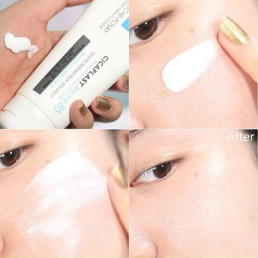 La Roche Posay - Kem ngừa mụn Cicaplast Baume B5 40ml và 100ml