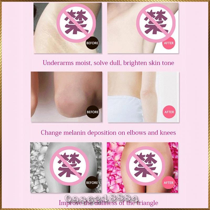 Kem xoá thâm nhanh làm trắng đều màu da Aichun Whitening Cream For Sensitive Areas A5694