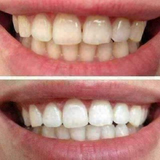 Bột Trắng Răng Baking Soda NT Hàng Chất Lượng Cao